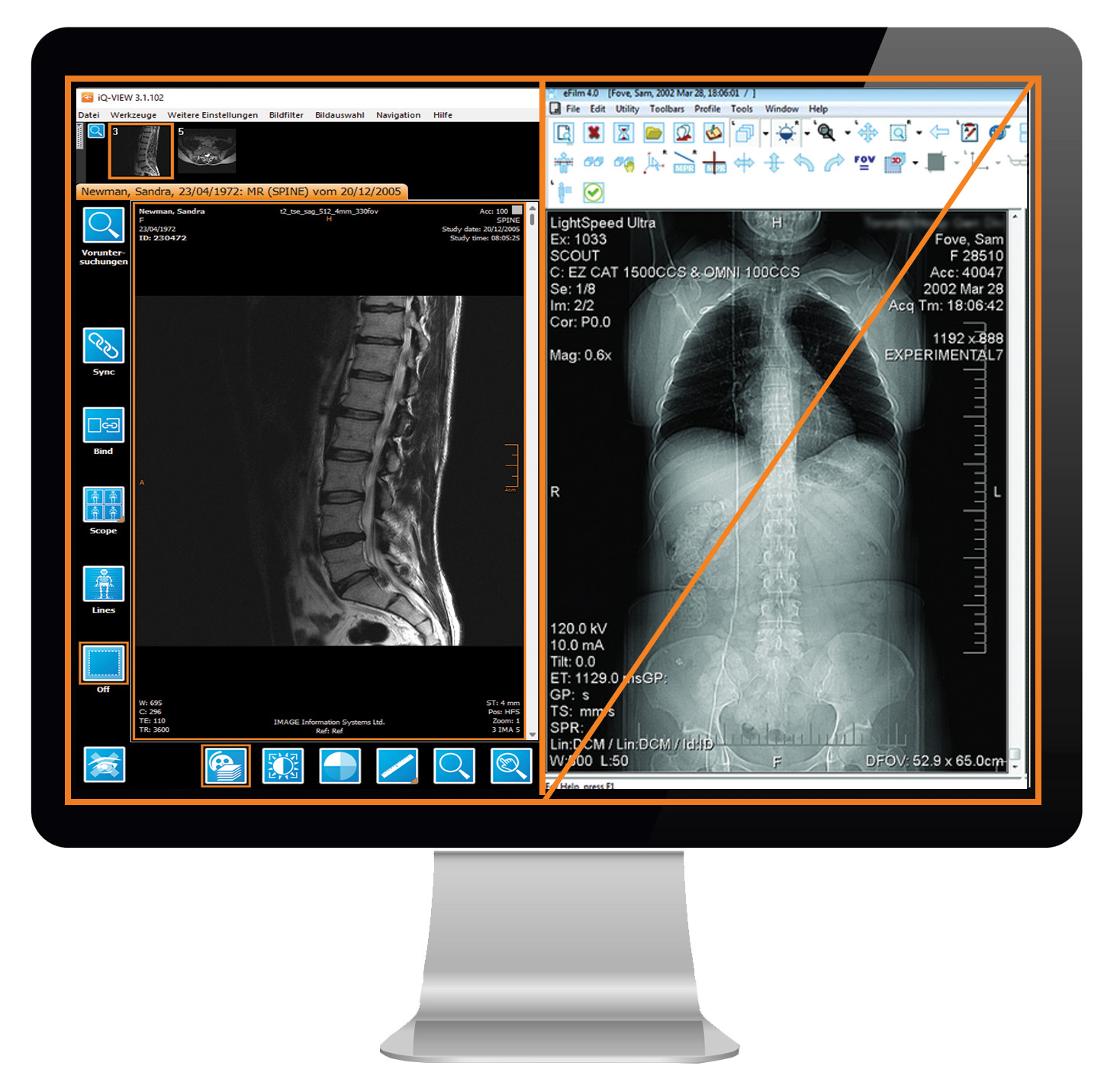 iQ-VIEW/PRO - eFilm: There is hardly any difference in appearance, but functionally iQ-VIEW/PRO scores with additional features. iQ-VIEW/PRO - eFilm: There is hardly any difference in appearance, but functionally iQ-VIEW/PRO scores with additional features.